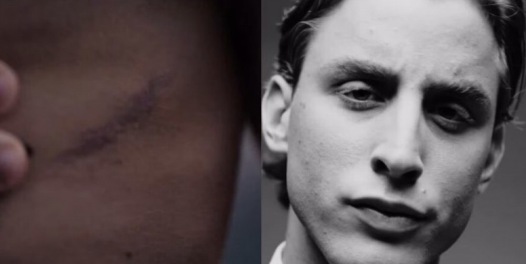 非凡, 你是如何成